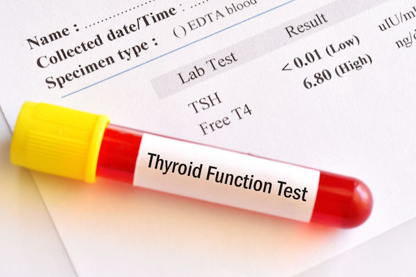 A thyroid function blood test