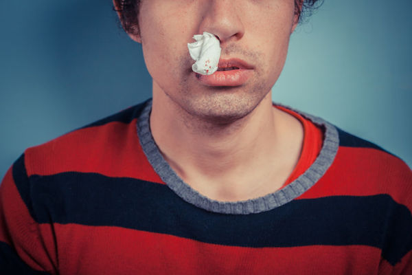A man trying to stop his nosebleed with a tissue