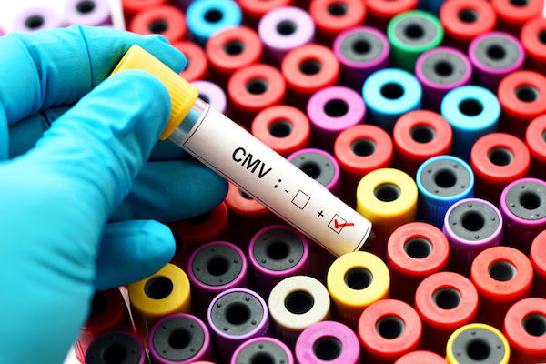 A Cytomegalovirus blood sample