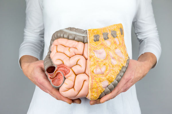 A doctor holding a model of the intestines