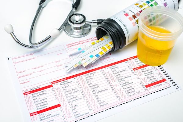 Medical tests for a kidney infection