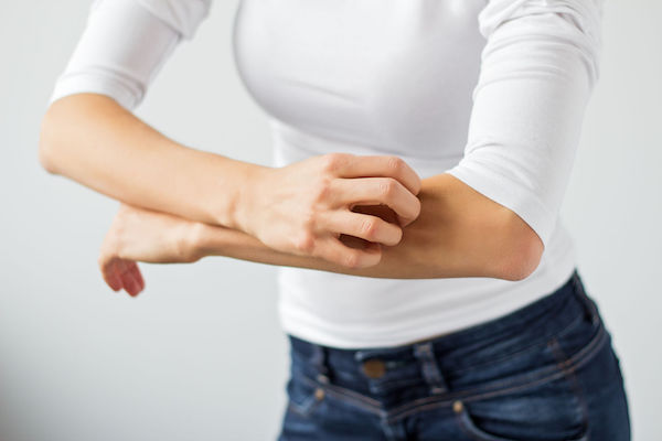 A woman with eczema scratching her arm